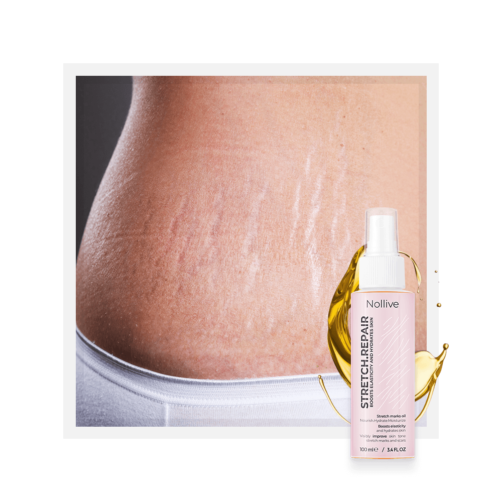 Ulei Antivergeturi Jolen: Stretch.Repair 3