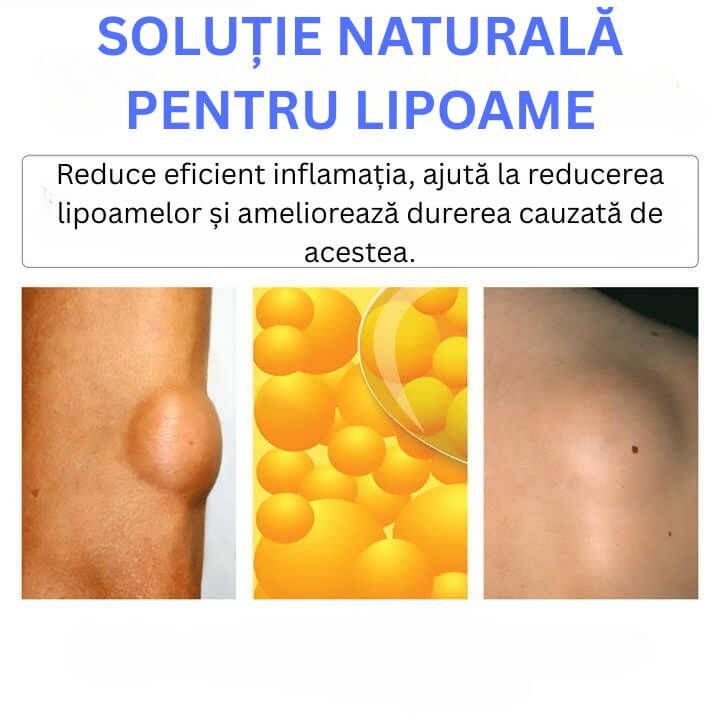 Crema Eliminare Lipomi 3