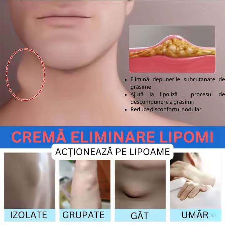 Crema Eliminare Lipomi 5