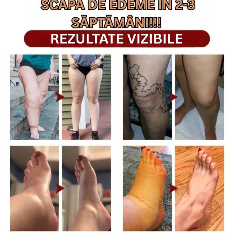Super Crema pentru Drenaj Limfatic si Edeme 3