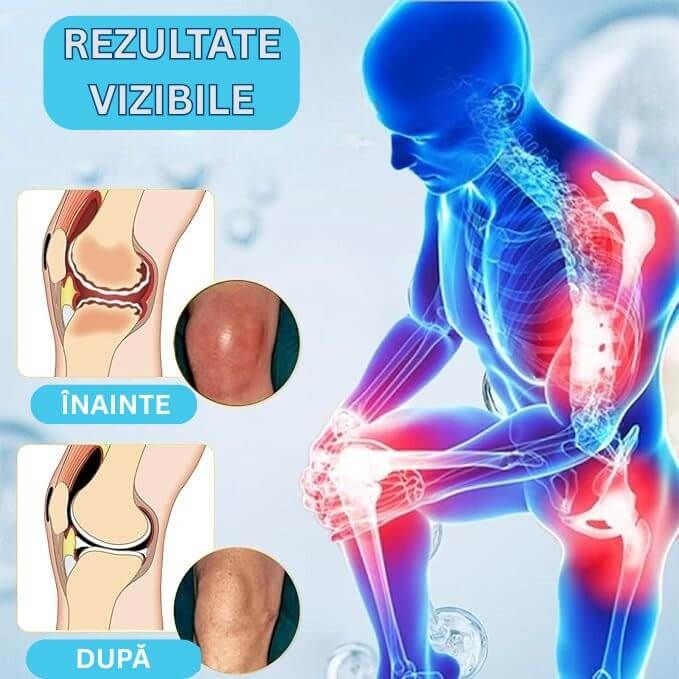 Crema Stimulare Colagen pentru Articulatii si Cartilaje 5