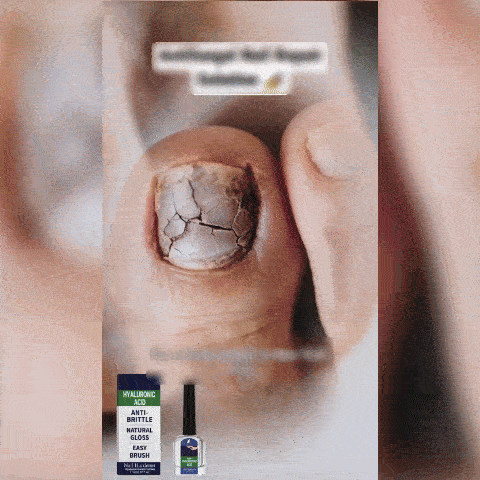Intaritor pentru Unghii Fragile cu Vitamina E