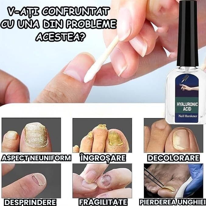 Intaritor pentru Unghii Fragile cu Vitamina E 3