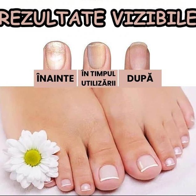 poate hidrata in profunzime unghiile si pielea din jur ajutand la reducerea uscaciunii si a aspectului crapat contribuind la o crestere vizibil mai sanatoasa a unghiilor. before – inainte using 1