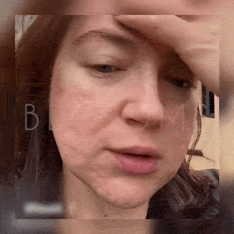 gif2 roller acid hialuronic