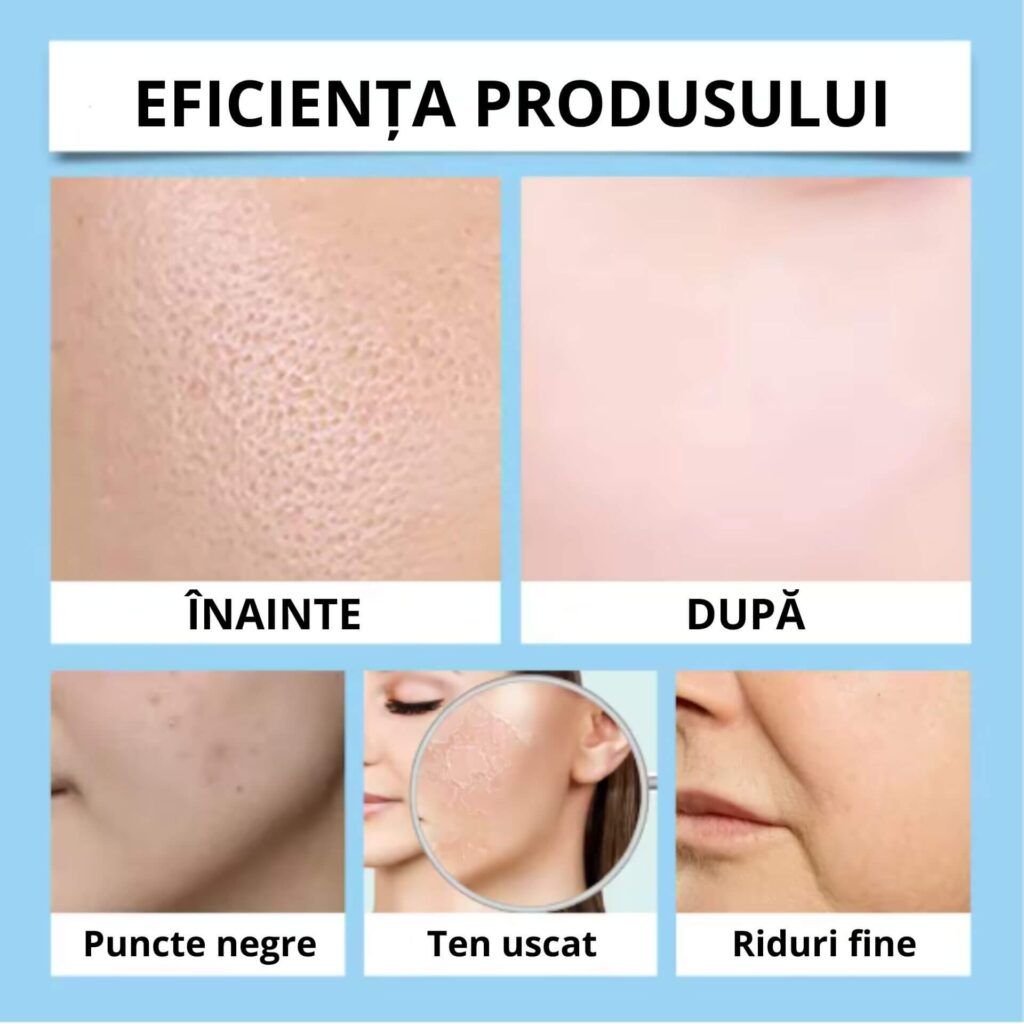 poza 3 3