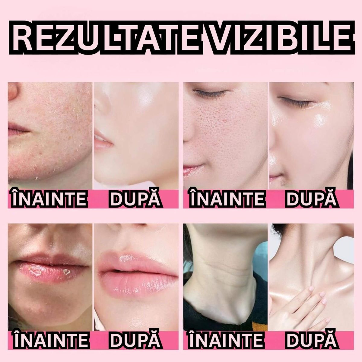 REDUCE RIDURILE VIZIBILE
