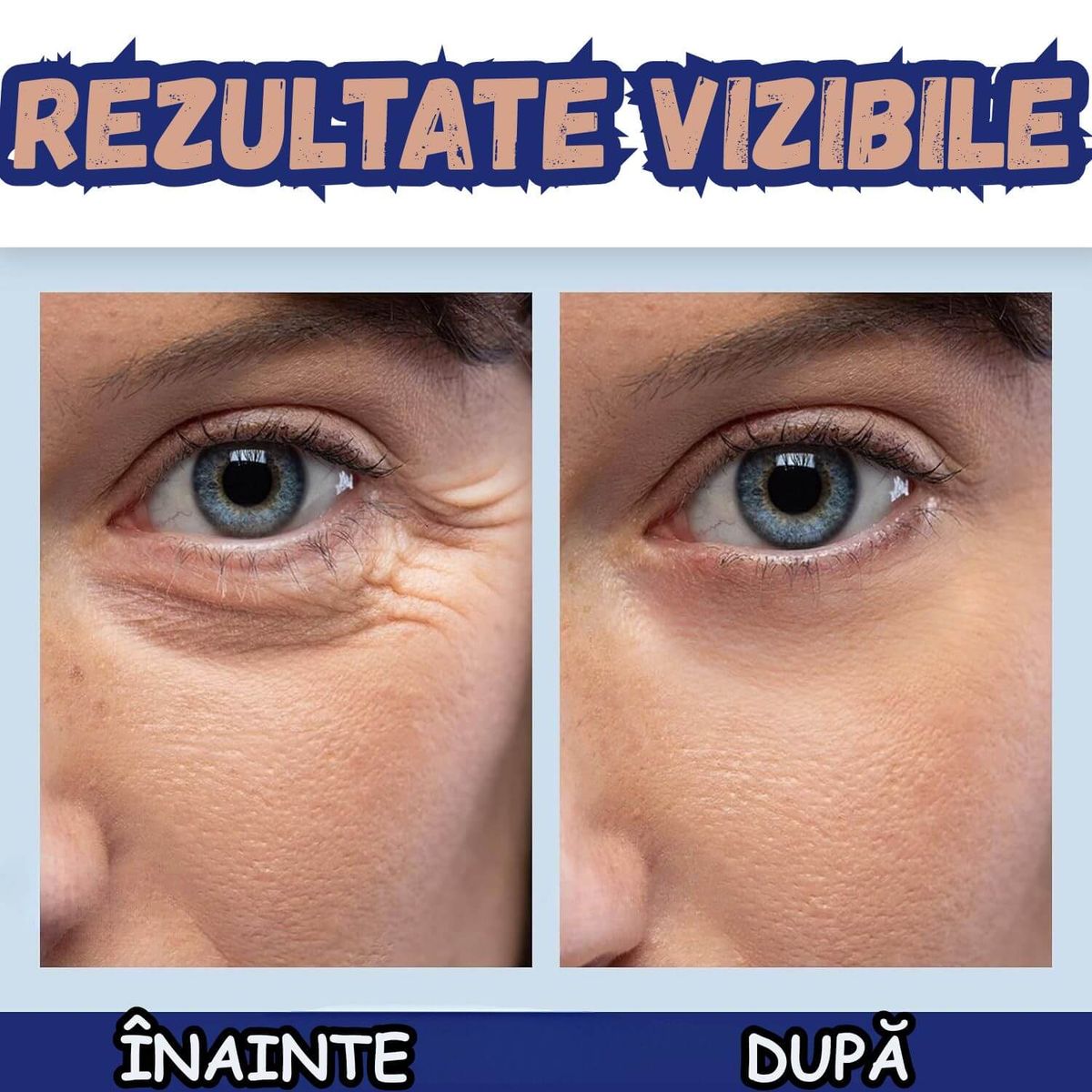 Crema Anti-Rid cu Efect de Lifting 5