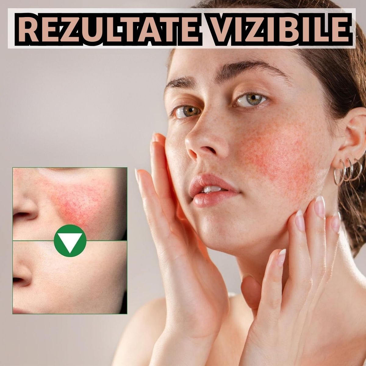 HIDRATEAZĂ ȘI CATIFELEAZĂ
