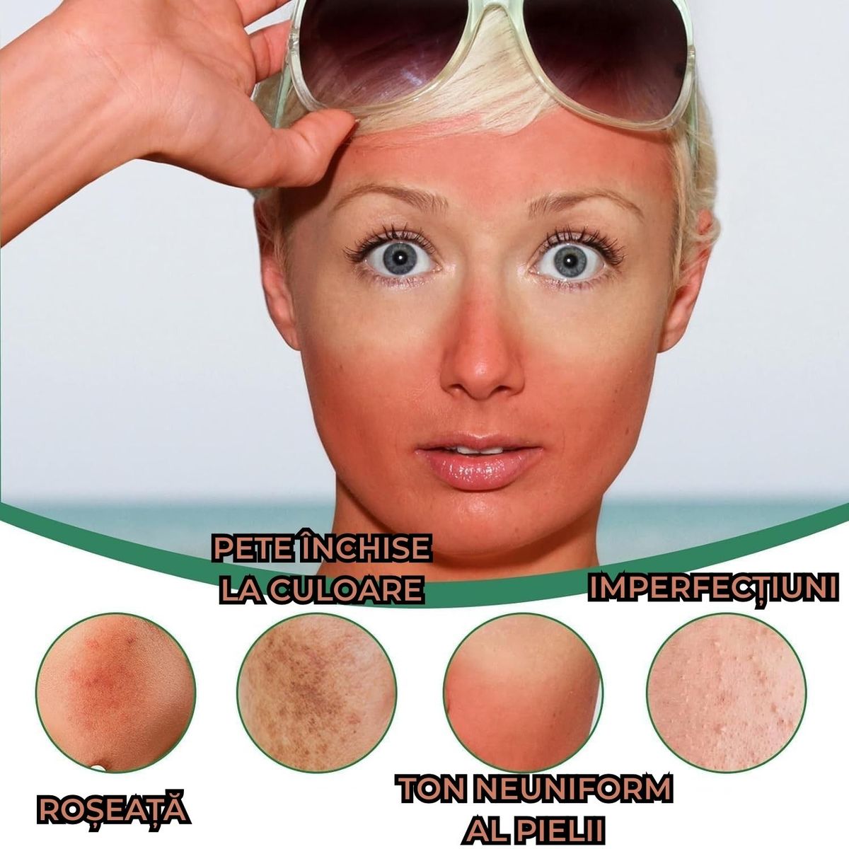 Crema Corectoare a Rosetii Fetei 3