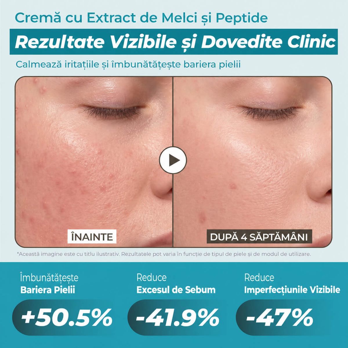 COMPLEX DE 5 PEPTIDE PENTRU ÎNGRIJIRE COMPLETĂ