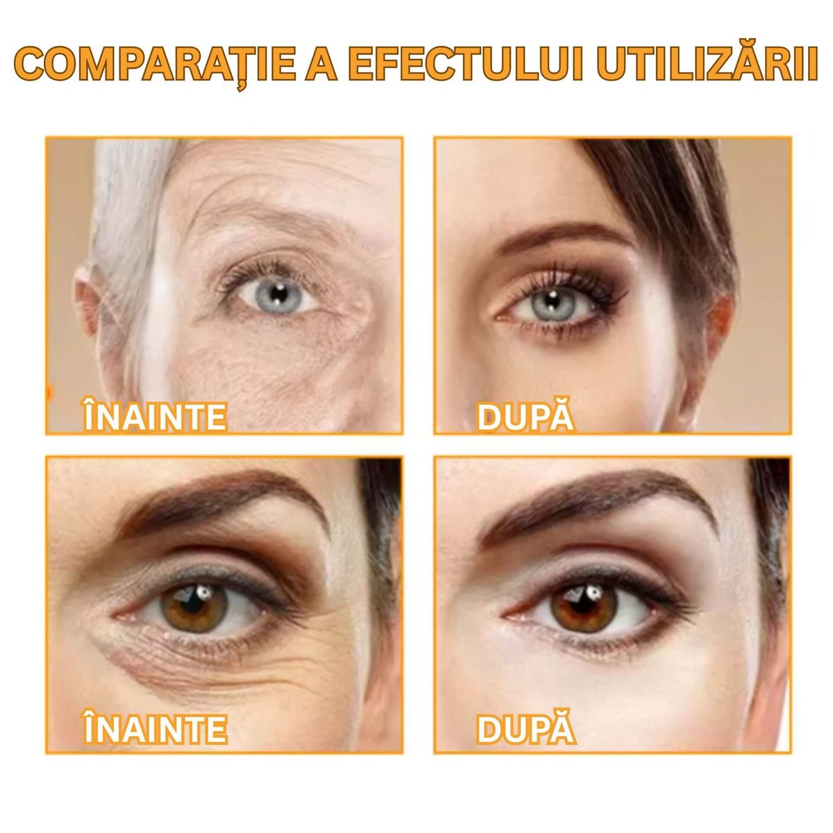 ASPECT MAI NETED AL PIELII
