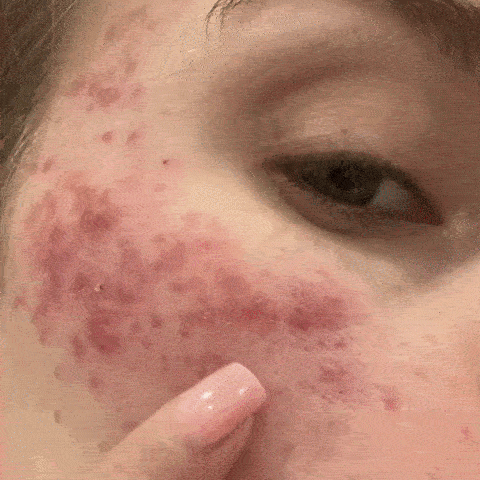 Crema Jeleu Hidratanta cu Colagen si Niacinamide