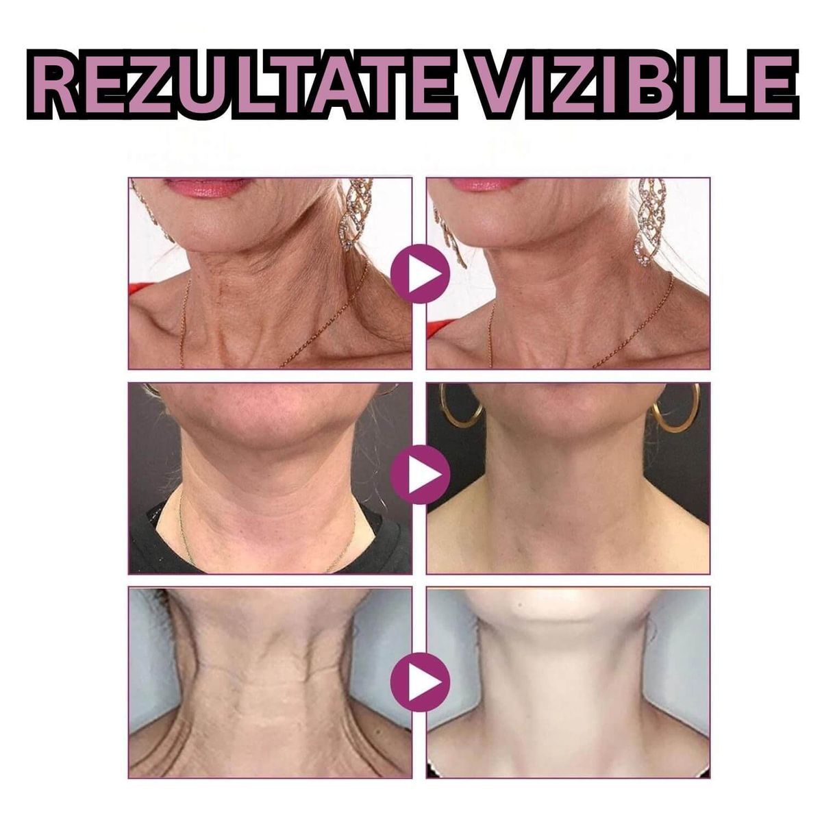 FERMITATE VIZIBILA