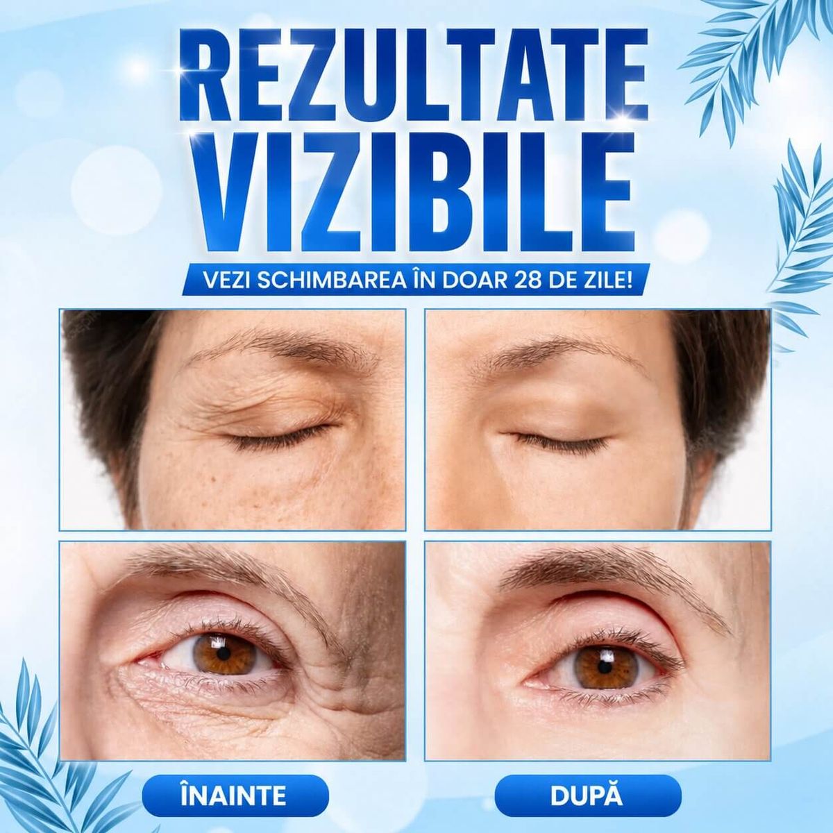 Crema pentru Cearcane si Efect de Lifting 3