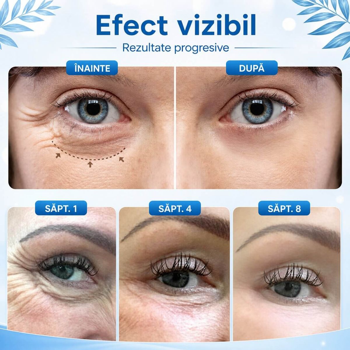 Crema pentru Cearcane si Efect de Lifting 5