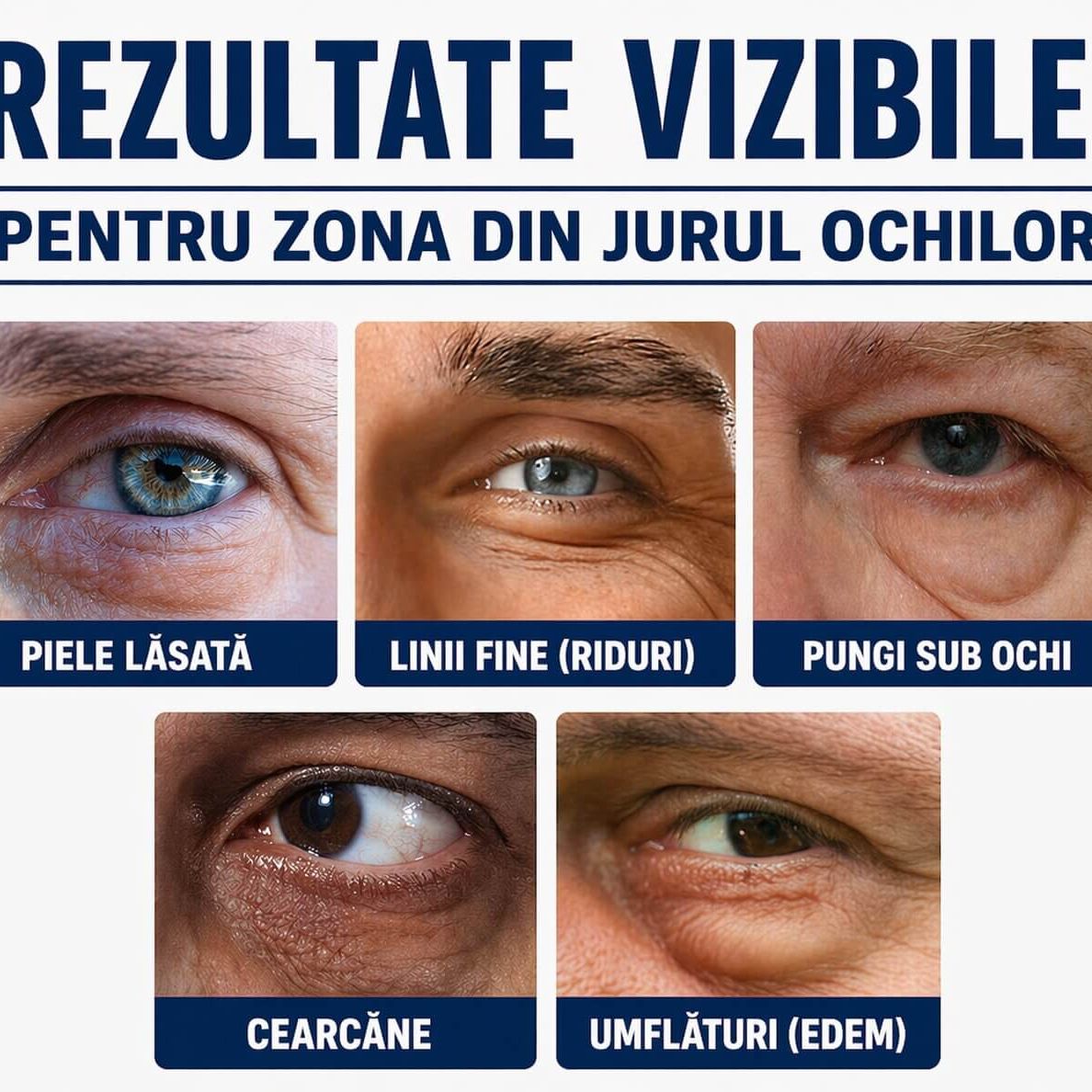 ÎMBUNĂTĂȚEȘTE VIZIBIL ASPECTUL