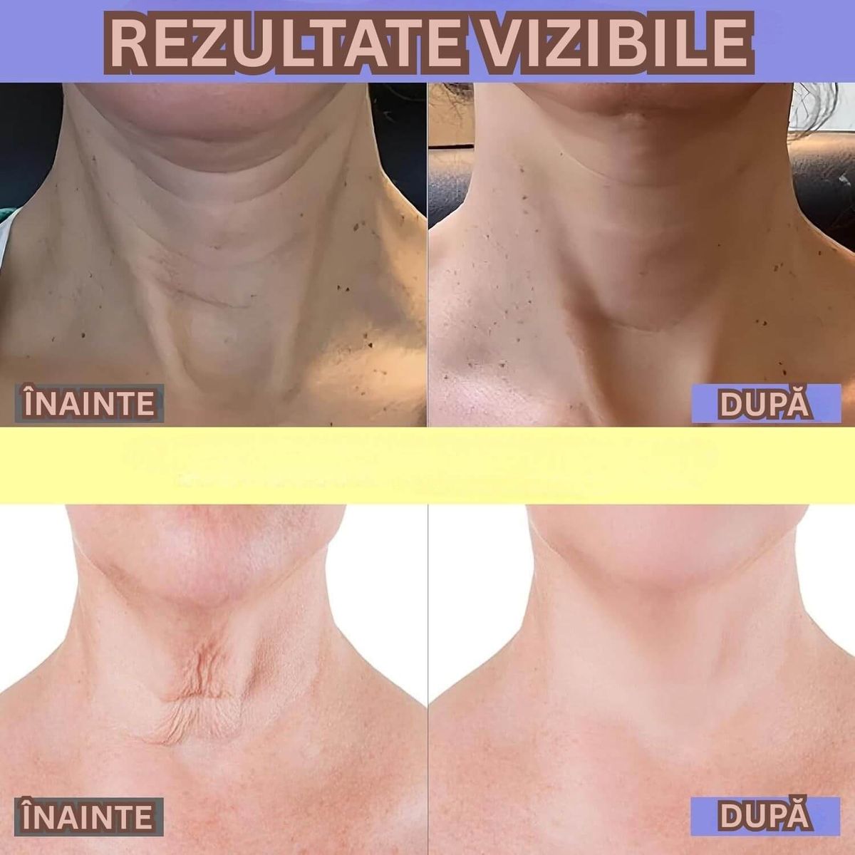 Crema pentru Intinerirea Pielii 5