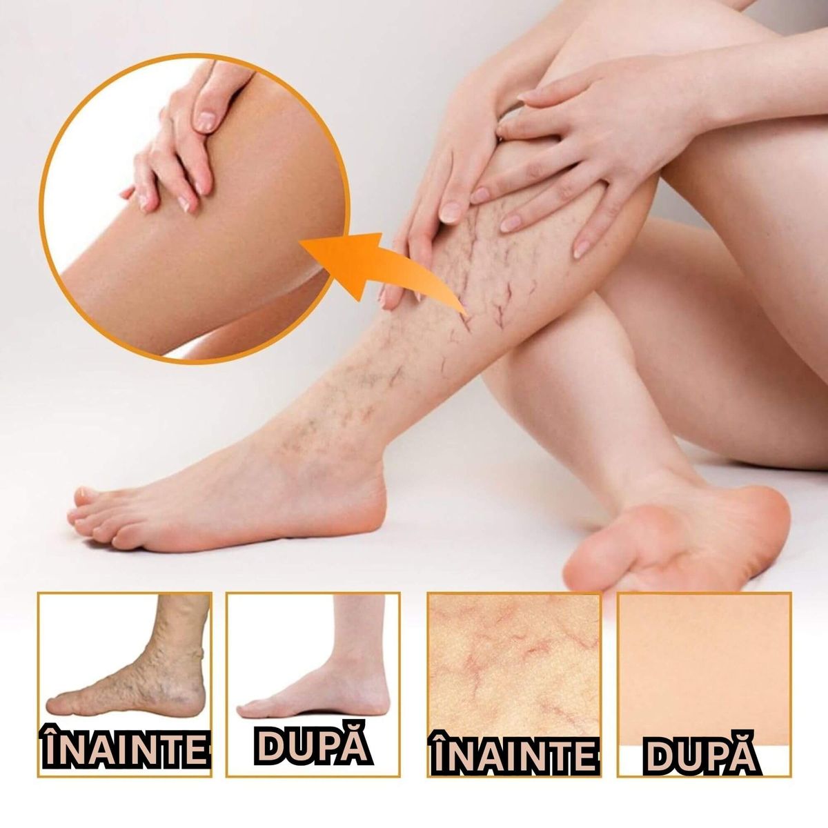 CONFORT PENTRU PICIOARE OBOSITE