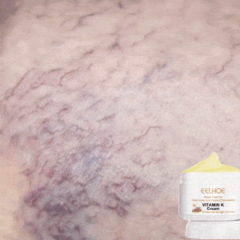 Crema pentru Varice
