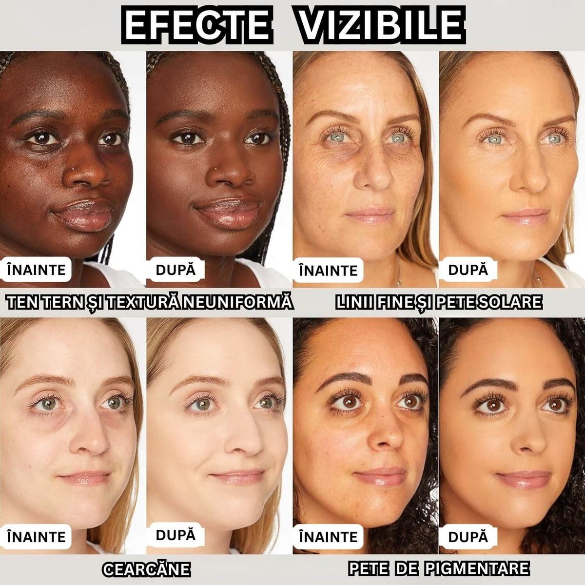 Crema Perfectionare Ten cu Imperfectiuni 3