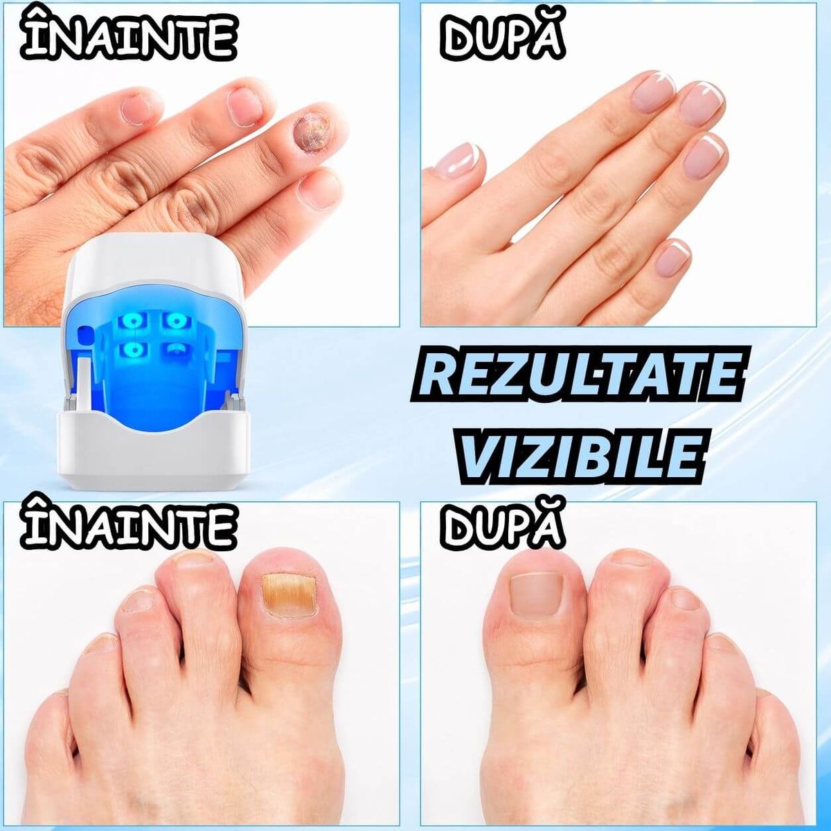 ACȚIUNE DIRECTĂ CU LUMINĂ ASUPRA ZONEI AFECTATE