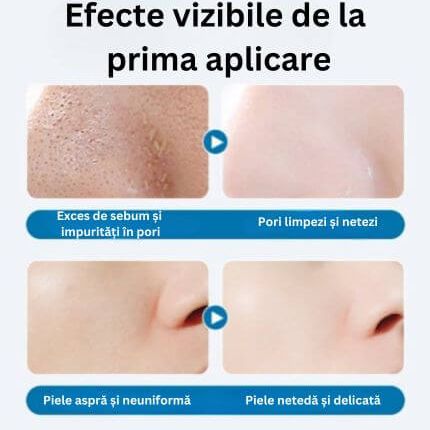 Curățare profundă fără iritații