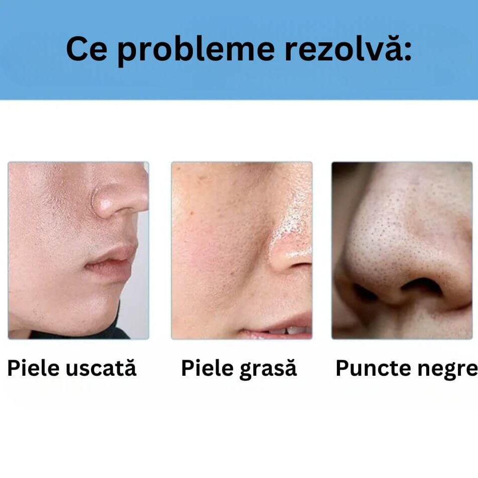 Fiole pentru Pori Negrii 3
