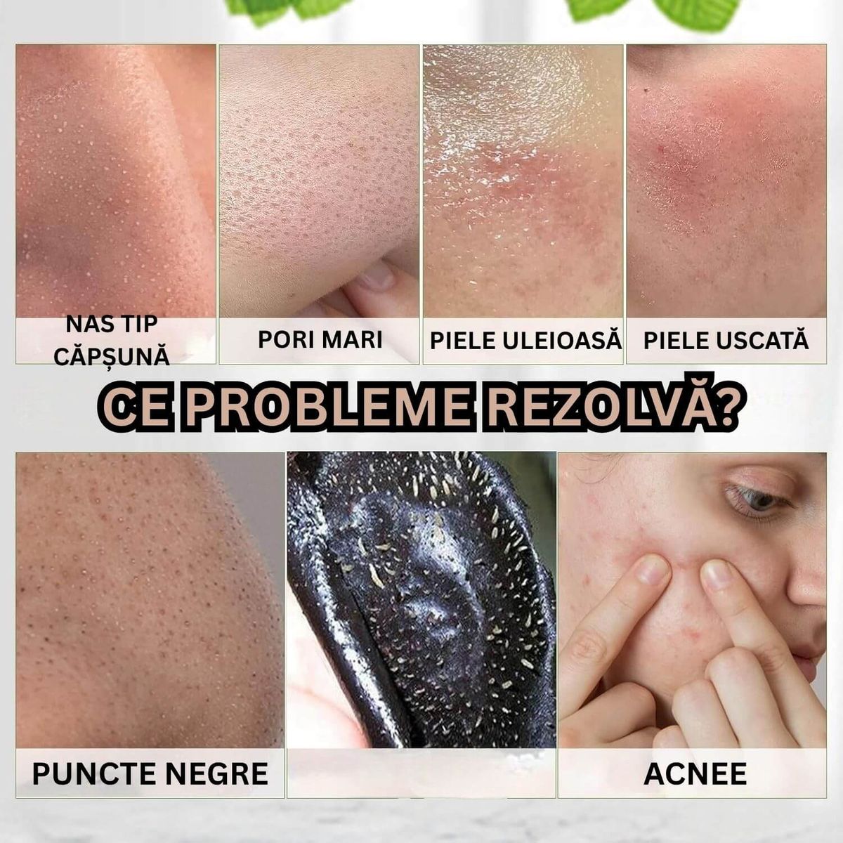 Masca pentru Puncte Negre 3