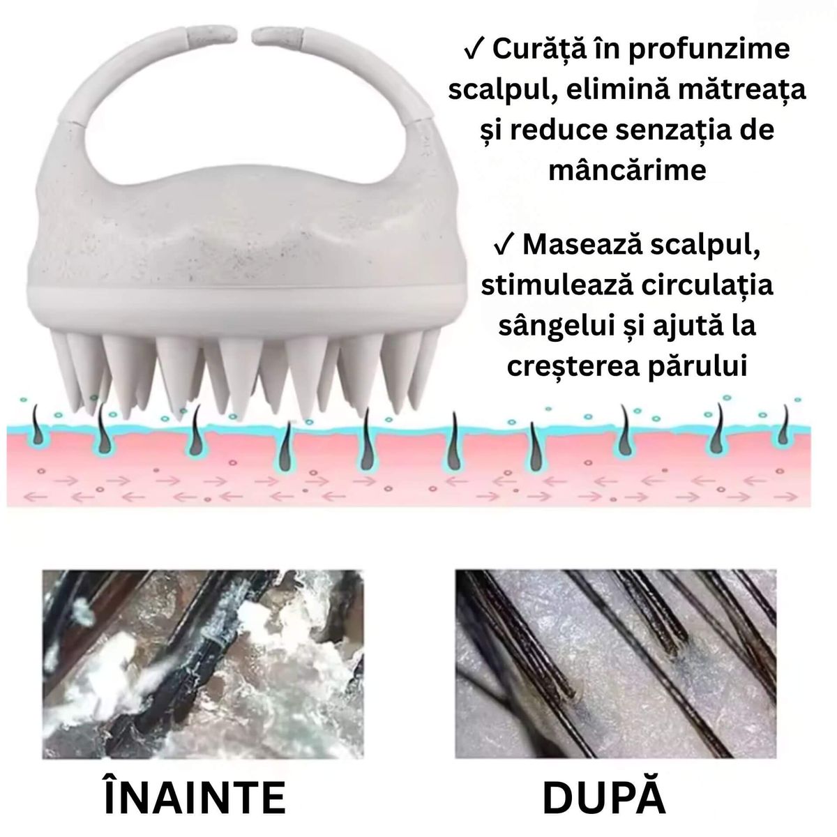 Perie Exfolianta pentru Scalp 3
