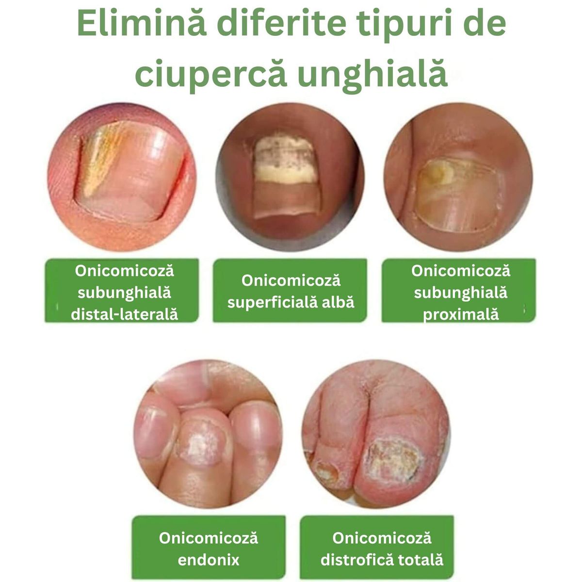 Roll pentru Stimularea Cresterii Unghiilor 5