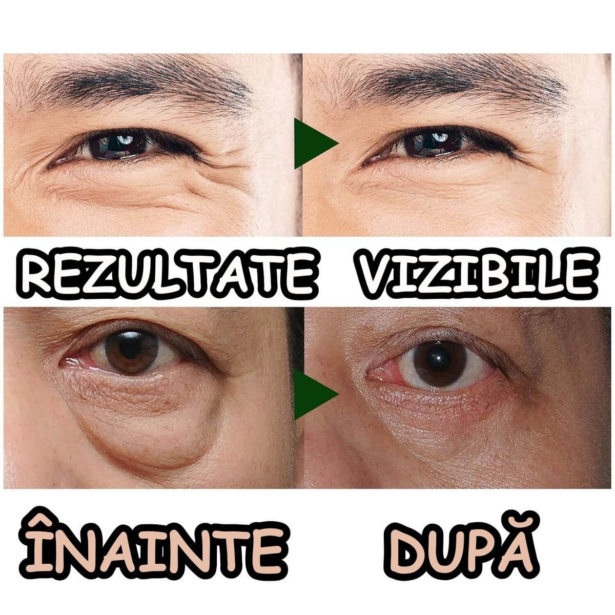 Roller pentru Ochi Umflati 3