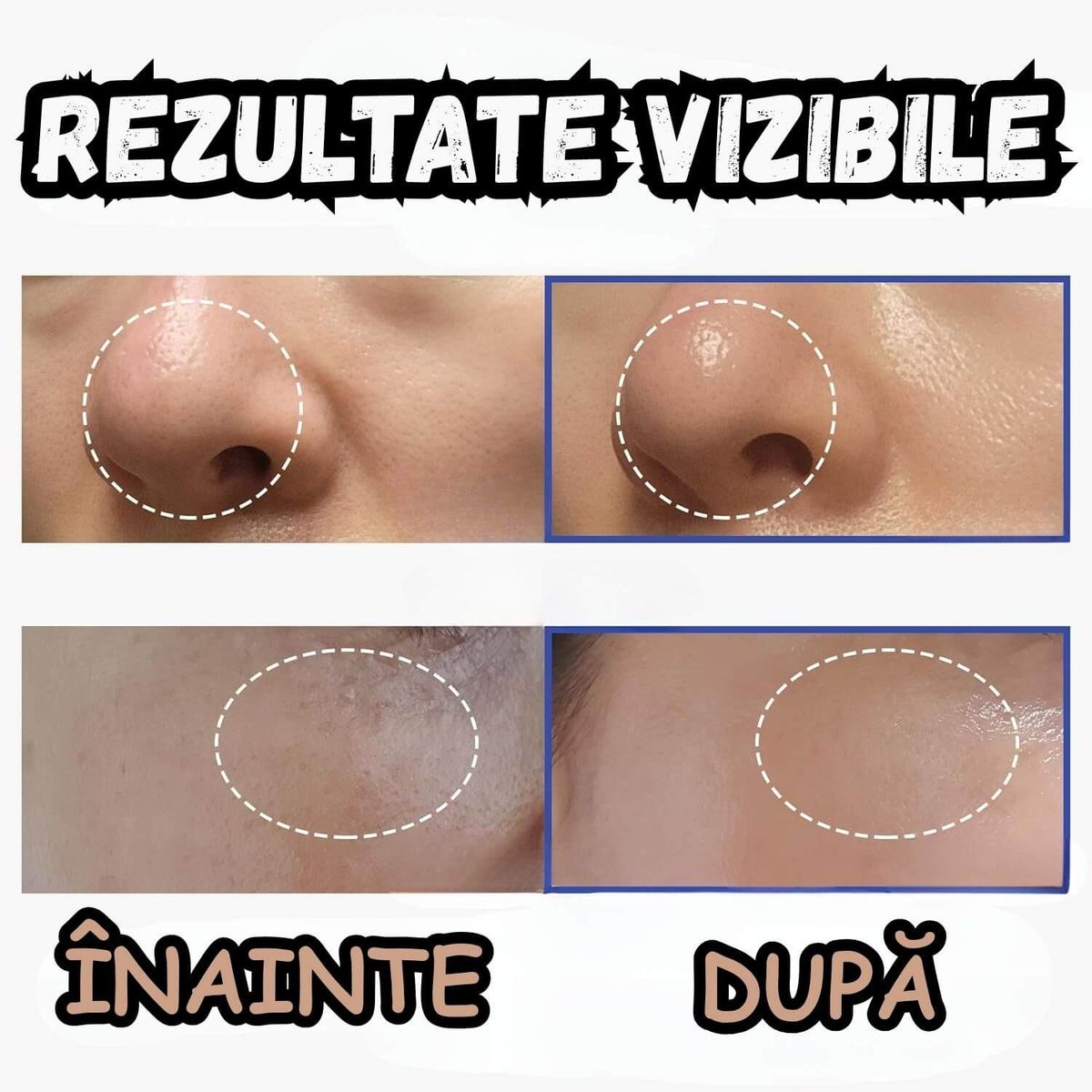 SPRIIJINĂ ASPECTUL UNIFORM AL TENULUI