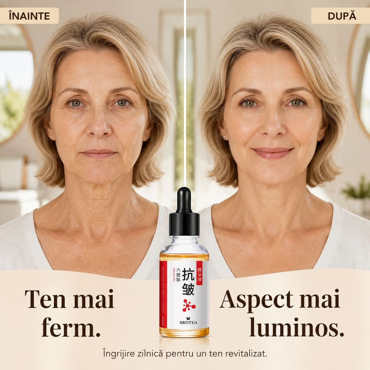 SUSȚINE ASPECTUL FERM AL TENULUI