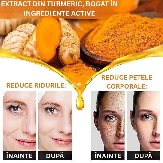 Ser cu Turmeric pentru Pete Corporale 3