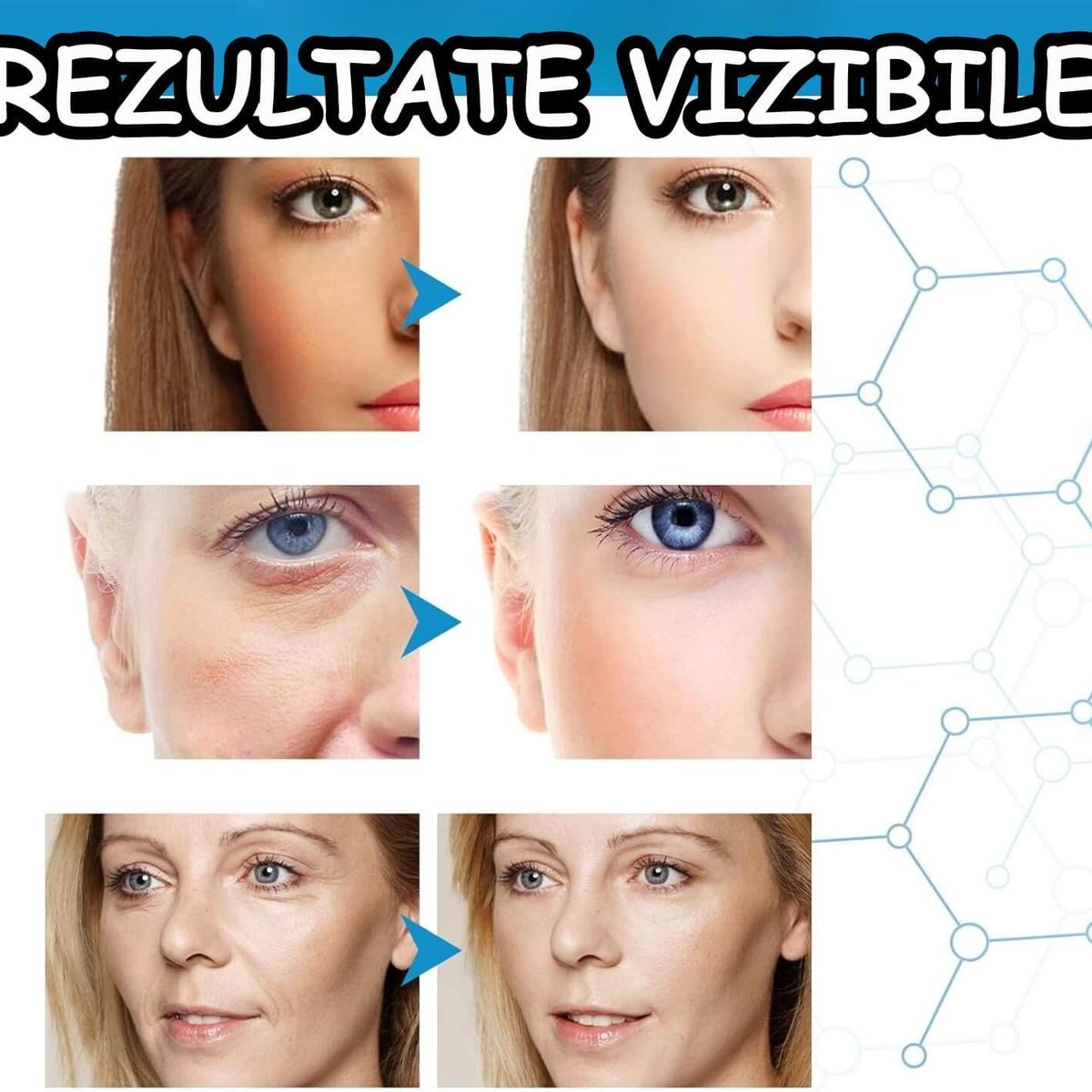 SENZAȚIE DE FERMITATE
