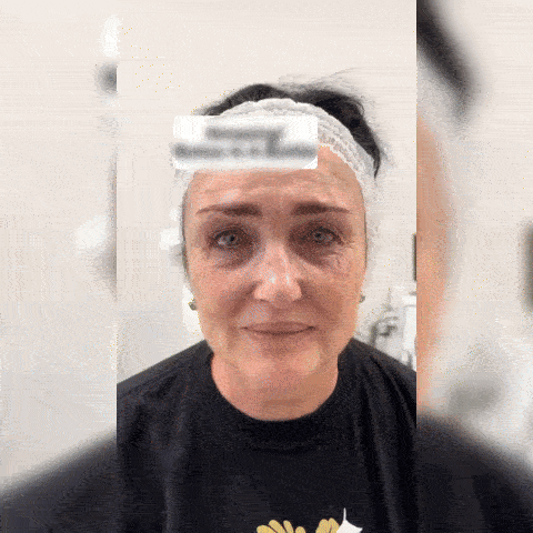Ser pentru Lifting Facial si Anti-Riduri
