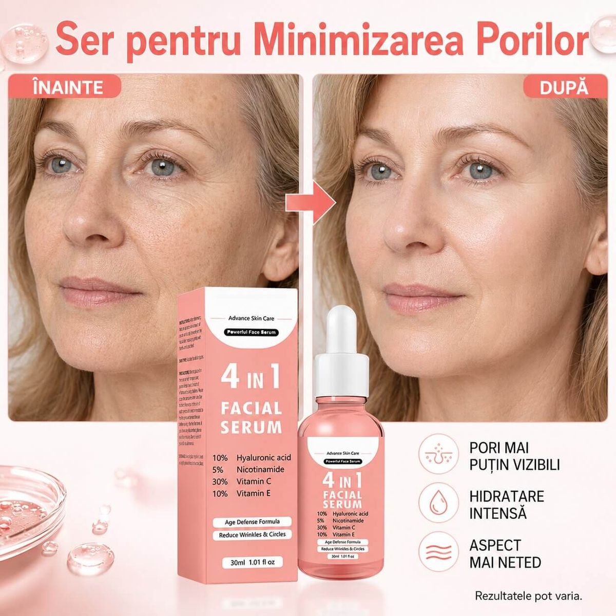 Ser pentru Minimizarea Porilor 5