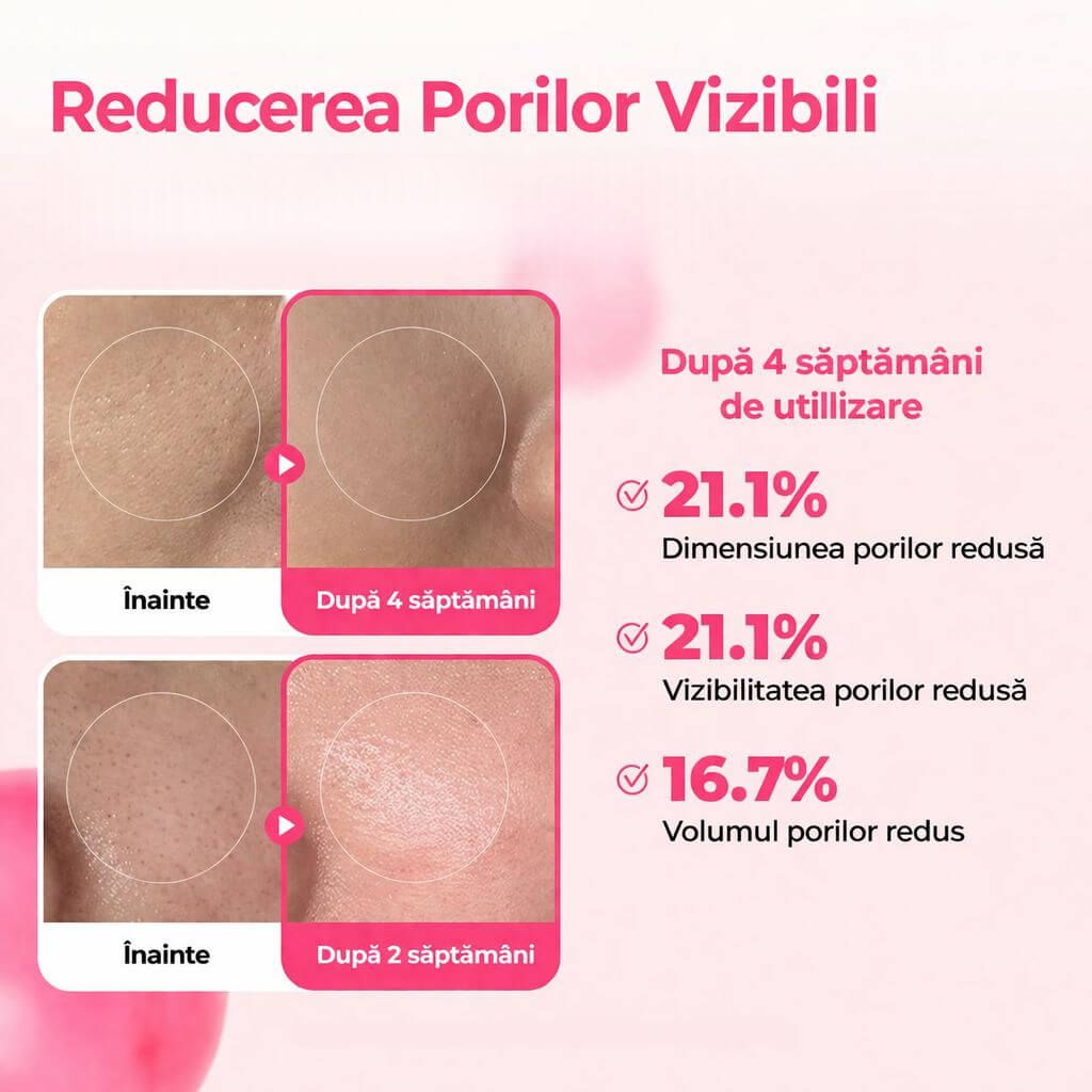 REDUCE ASPECTUL PORILOR VIZIBILI