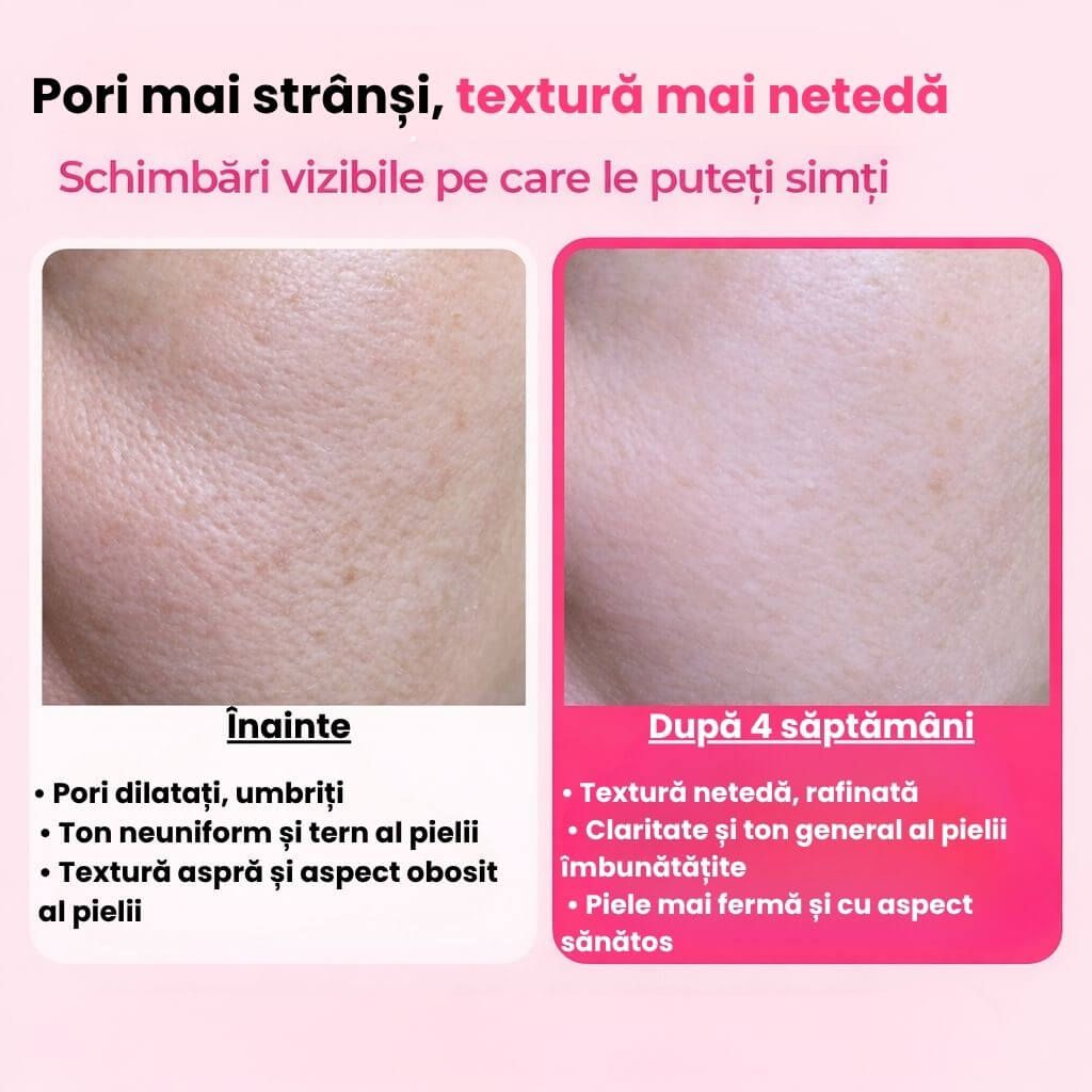 Ser Terapie Micro-needling Pori Faciali cu Vitamina B12 5