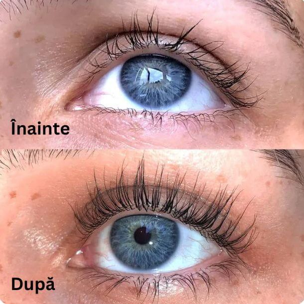 Hrănește genele de la rădăcină