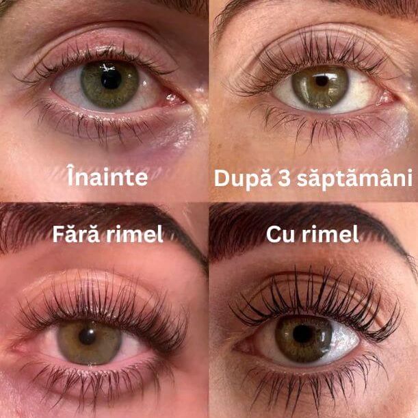 Compoziție bazată pe ingrediente naturale
