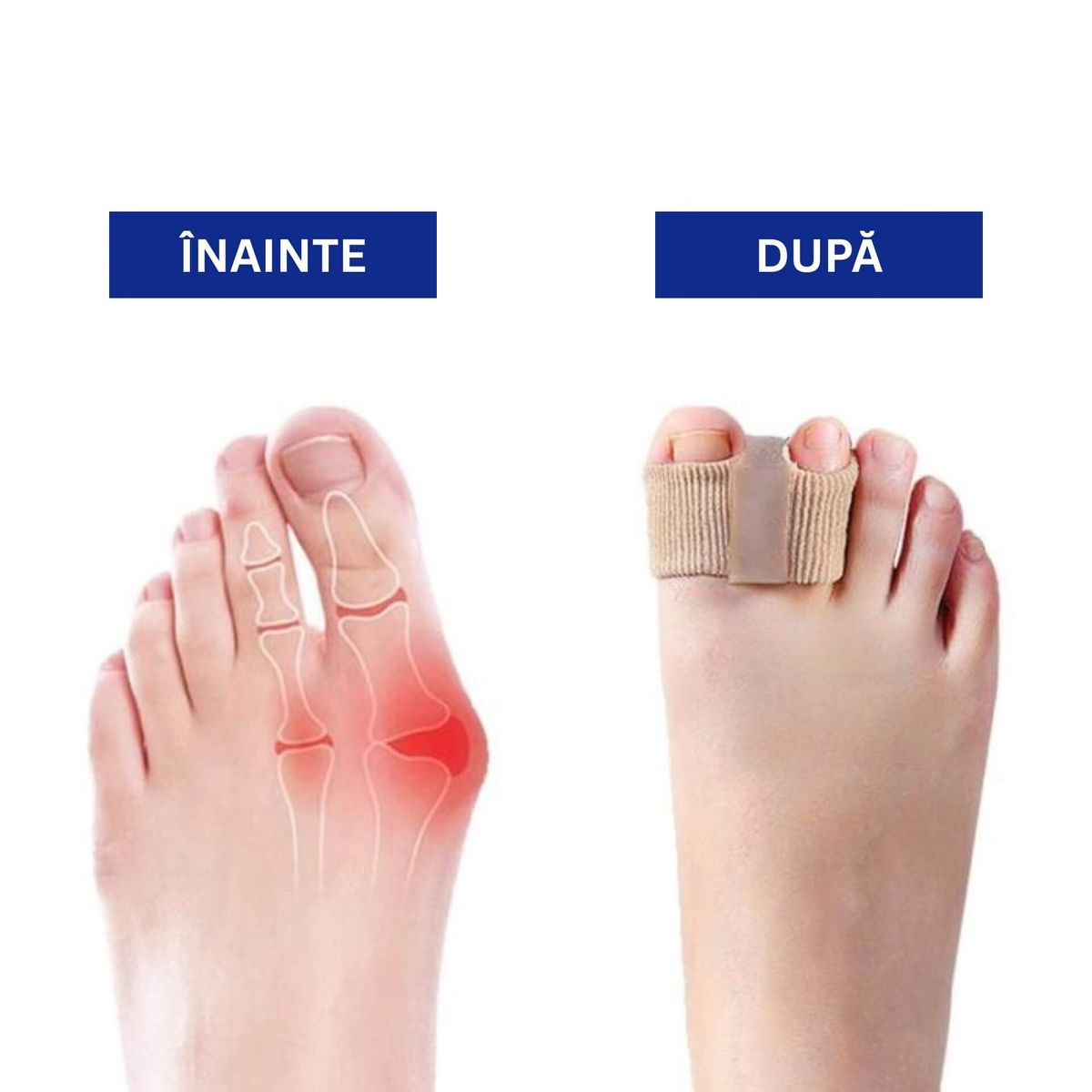 Set 2 Separatoare pentru Degetele Suprapuse 3
