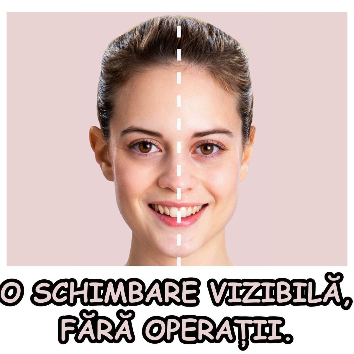 Set 6 Plasturi pentru Corectarea Urechilor 5