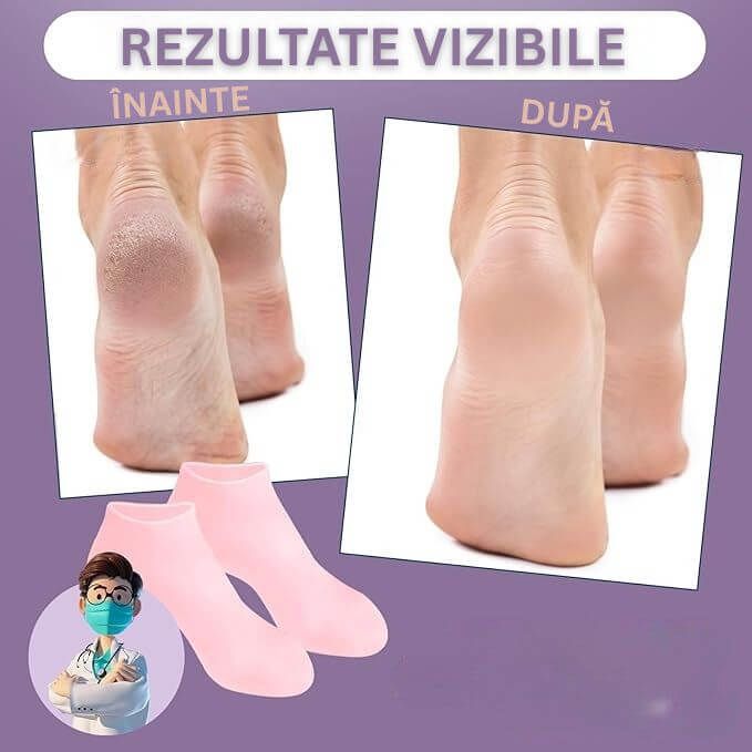 Sosete din Silicon pentru Calcaie Crapate 5