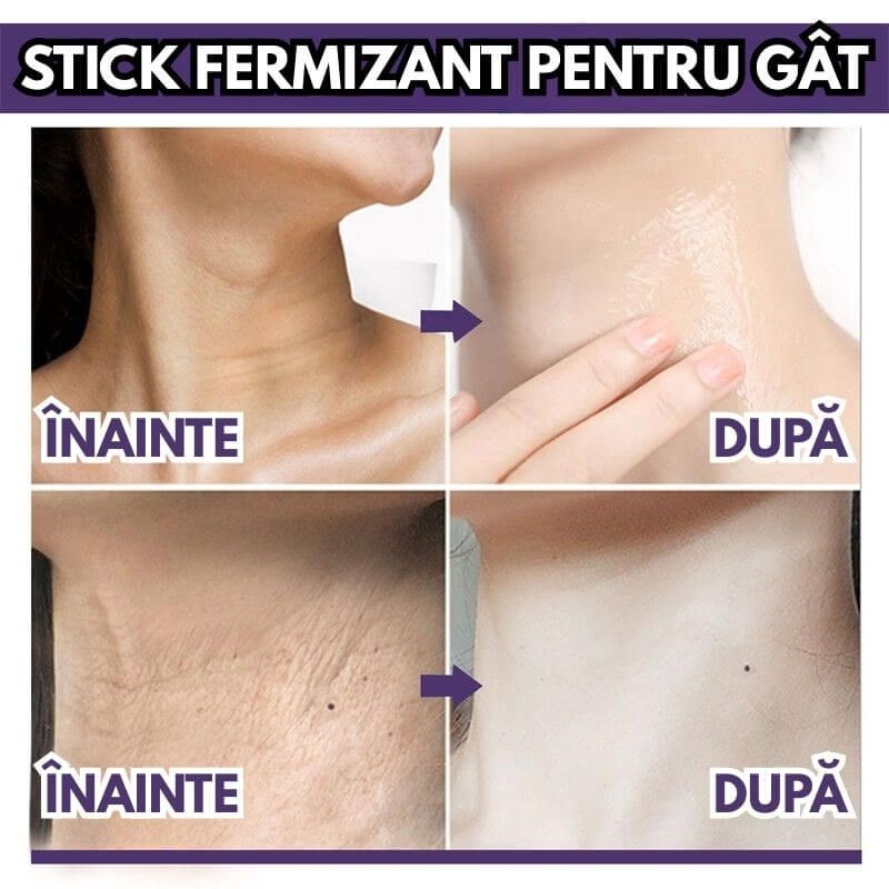 AJUTĂ LA MENȚINEREA FERMITĂȚII NATURALE