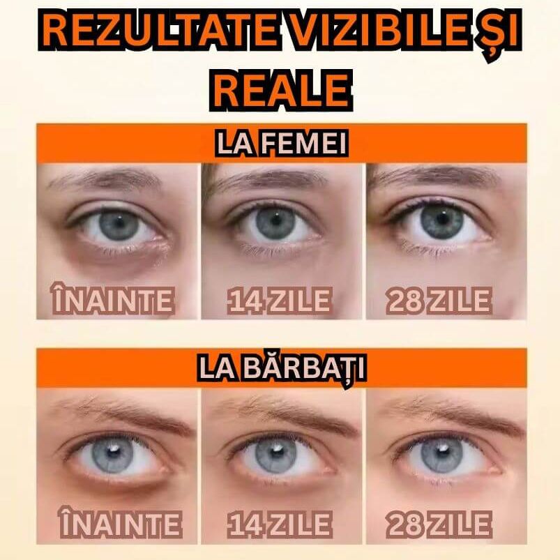 HIDRATARE INTENSĂ