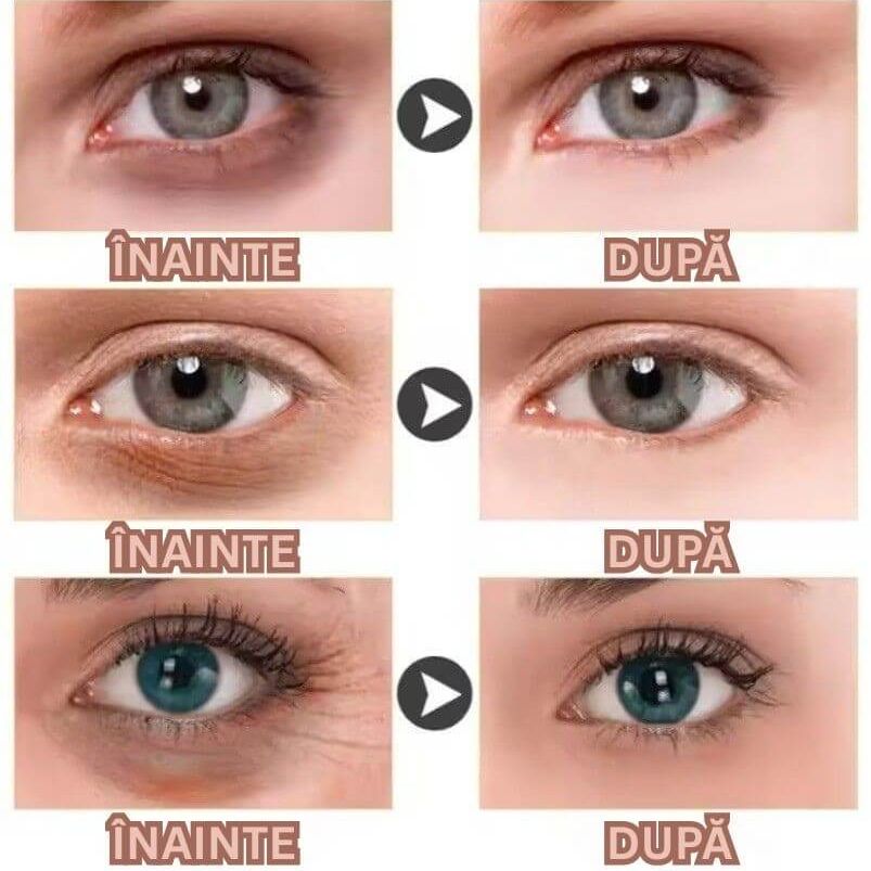 REDUCE CEARCĂNELE ȘI PUNGILE