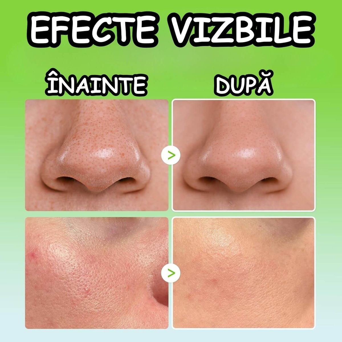 CONTRIBUIE LA ÎMBUNĂTĂȚIREA ELASTICITĂȚII PIELII