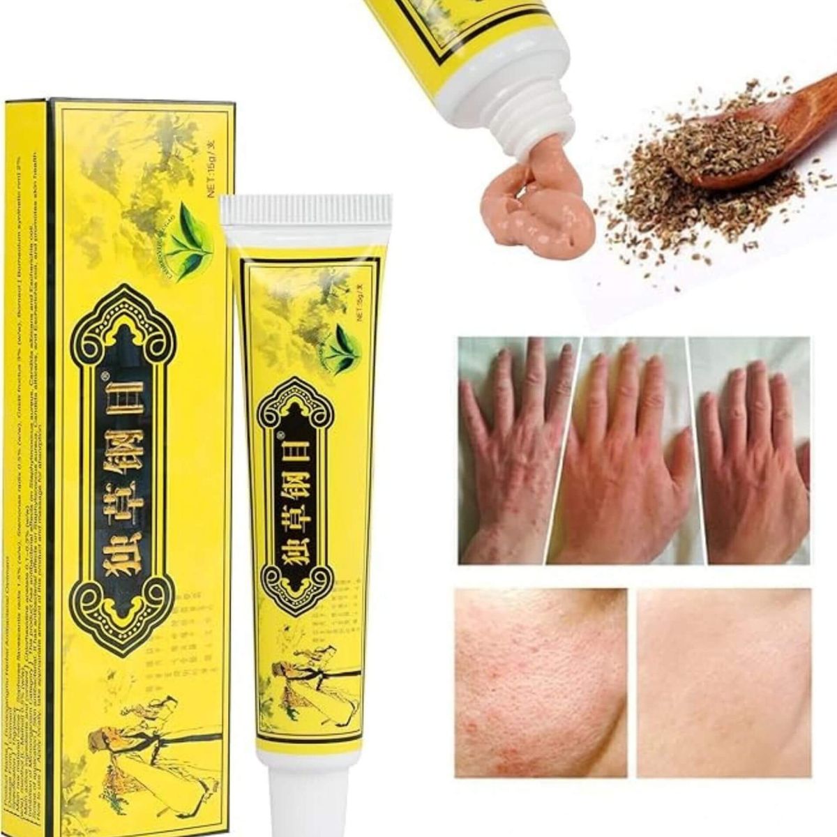 Super Crema Naturala Anti-Dermatita si Eczeme 3